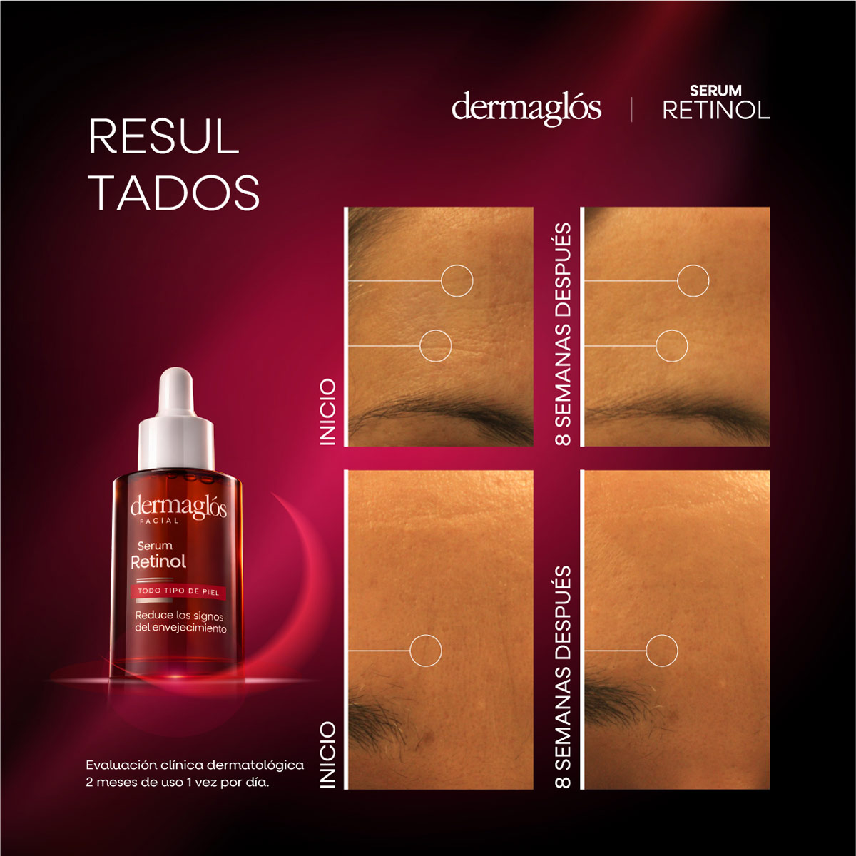 Serum Retinol Dermagl&oacute;s Facial 25 ml image number 10