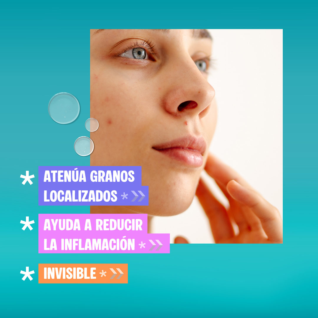 Gel Secante Control Acn&eacute; Dermagl&oacute;s 15 g image number 8