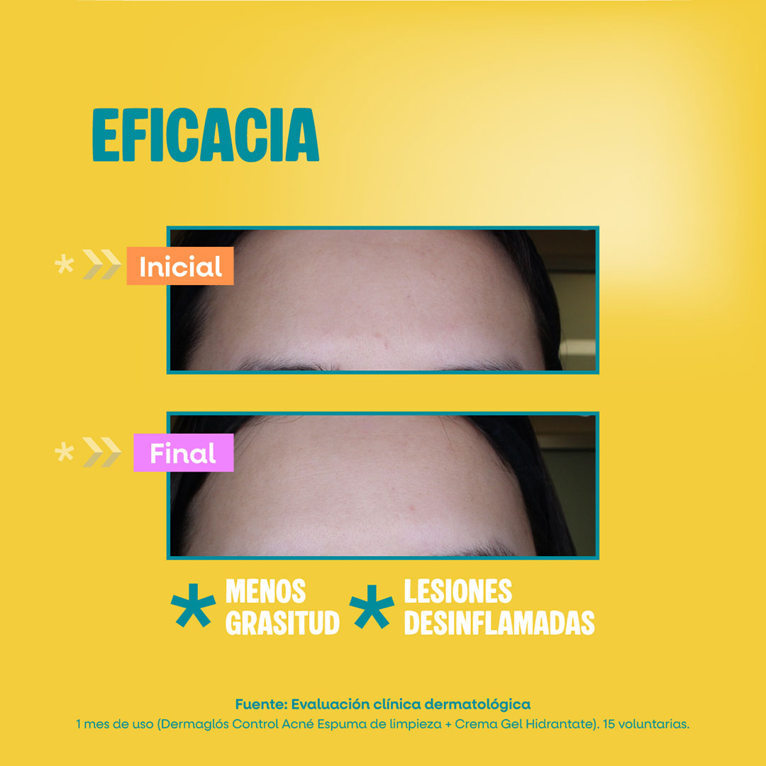 Crema Gel Hidratante Control Acn&eacute; Dermagl&oacute;s 50 g image number 8